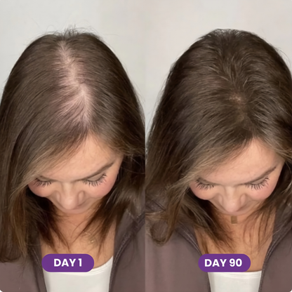 GLP-1 Hair Growth Accelerator Soft Chews