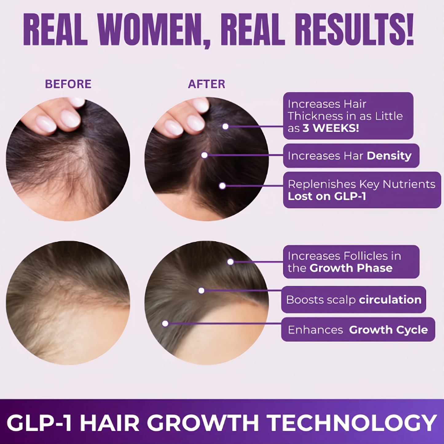 GLP-1 Hair Growth Accelerator Soft Chews