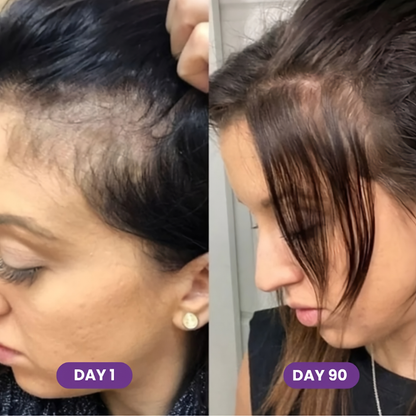 GLP-1 Hair Growth Accelerator Soft Chews